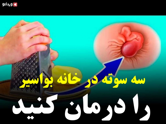 درمان فوری درد بواسیر در خانه