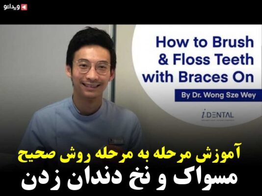 How To Brush And Floss Teeth With Braces